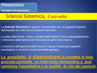  una capillaroscopia Sclerosi Sistemica,  il suo voltoLa Sclerosi Sistemica è spesso riconoscibile, da uno sguardo esperto,dall’aspetto del volto che si presenta ‘amimico’.La pelle della fronte  è tesa, a livello delle labbra si ha un assottigliamento( retrazione delle labbra) ed il formarsi di solchi tutto intorno. L’ampiezza dell’apertura della bocca si riduce; Il naso può apparire assottigliato e mostrare numerose teleangetasie.La  possibilità  di diagnosticarela malattia in fase precoce permette  un intervento tempestivo e  puòcambiare l’aspettativa e la qualità  di vita dei pazienti.
