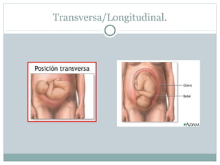 Transversa/Longitudinal.
 