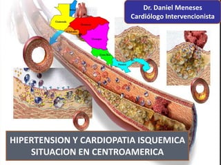 HIPERTENSION Y CARDIOPATIA ISQUEMICA
SITUACION EN CENTROAMERICA
Dr. Daniel Meneses
Cardiólogo Intervencionista
 
