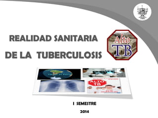 REALIDAD SANITARIA DE LA TUBERCULOSIS 
I SEMESTRE 
2014  