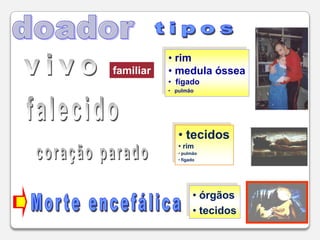 62. tipos de transplanteórgãostecidos rim