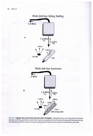 Siêu âm chẩn đoán