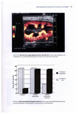Siêu âm chẩn đoán