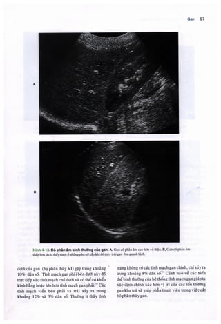 Siêu âm chẩn đoán