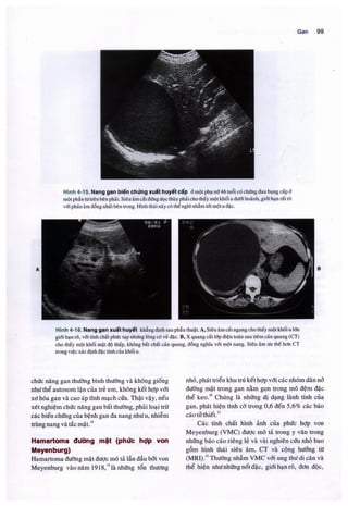 Siêu âm chẩn đoán