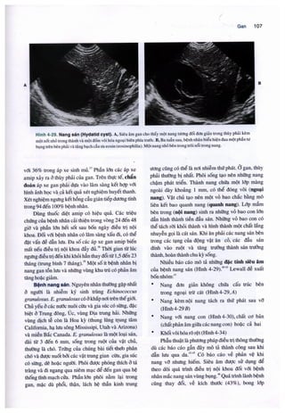 Siêu âm chẩn đoán