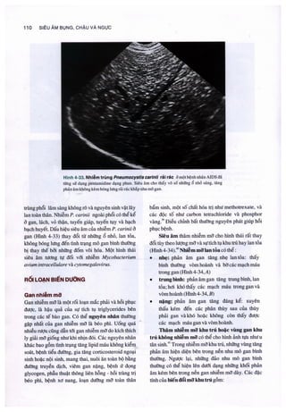 Siêu âm chẩn đoán