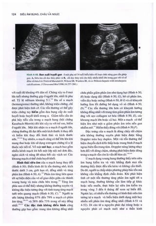 Siêu âm chẩn đoán