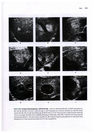 Siêu âm chẩn đoán