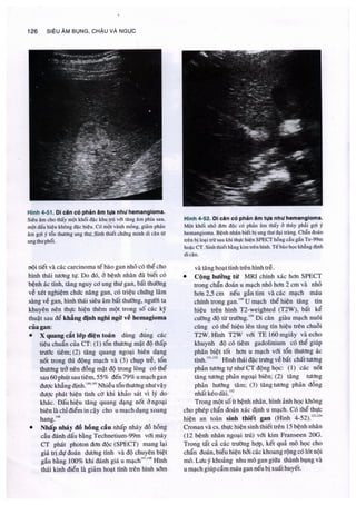 Siêu âm chẩn đoán