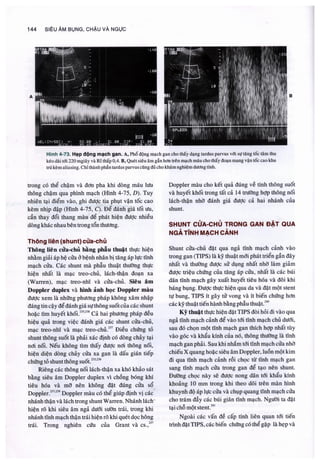 Siêu âm chẩn đoán