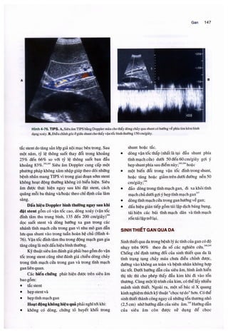 Siêu âm chẩn đoán