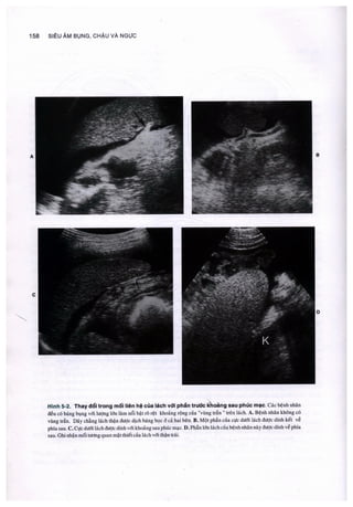 Siêu âm chẩn đoán