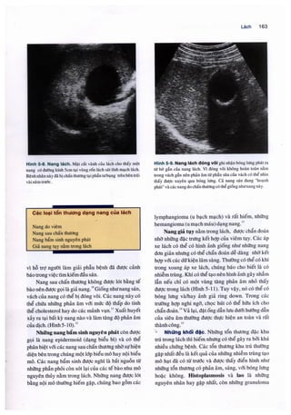 Siêu âm chẩn đoán