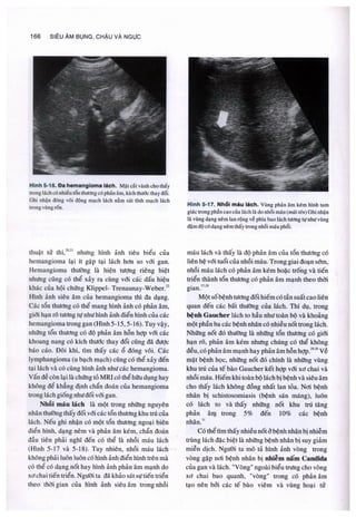 Siêu âm chẩn đoán