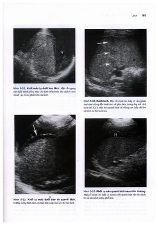 Siêu âm chẩn đoán