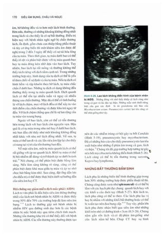 Siêu âm chẩn đoán