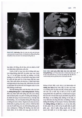 Siêu âm chẩn đoán