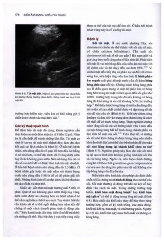 Siêu âm chẩn đoán