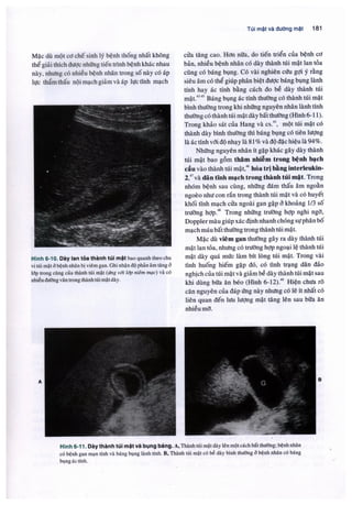 Siêu âm chẩn đoán