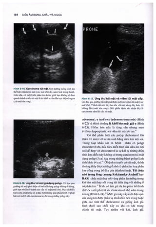 Siêu âm chẩn đoán