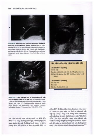 Siêu âm chẩn đoán