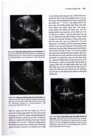 Siêu âm chẩn đoán