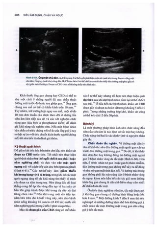 Siêu âm chẩn đoán