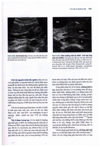 Siêu âm chẩn đoán