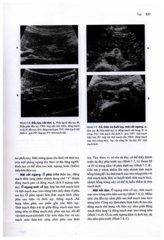 Siêu âm chẩn đoán