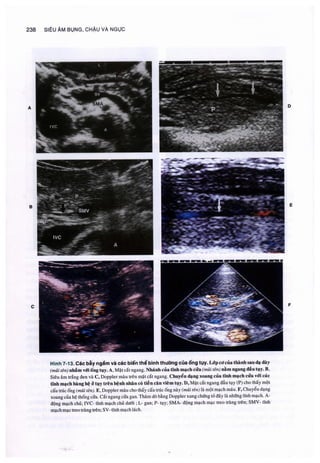 Siêu âm chẩn đoán