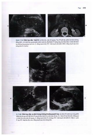 Siêu âm chẩn đoán