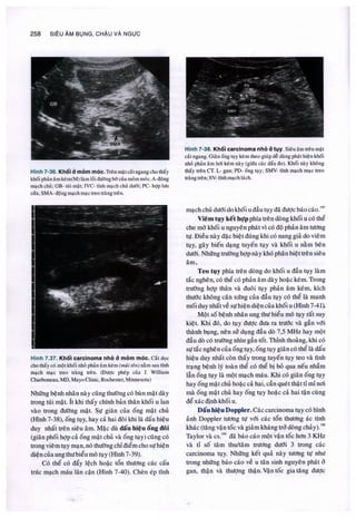 Siêu âm chẩn đoán