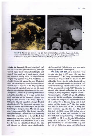 Siêu âm chẩn đoán