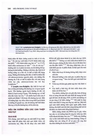 Siêu âm chẩn đoán