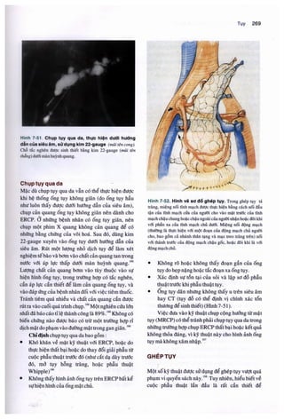 Siêu âm chẩn đoán