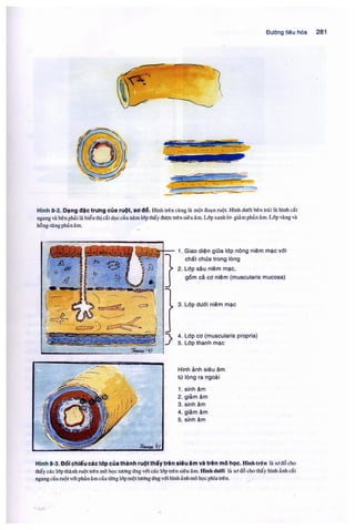 Siêu âm chẩn đoán