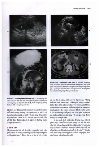 Siêu âm chẩn đoán