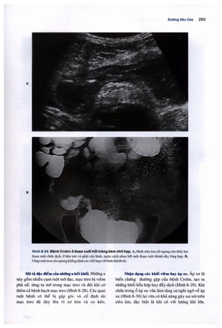 Siêu âm chẩn đoán