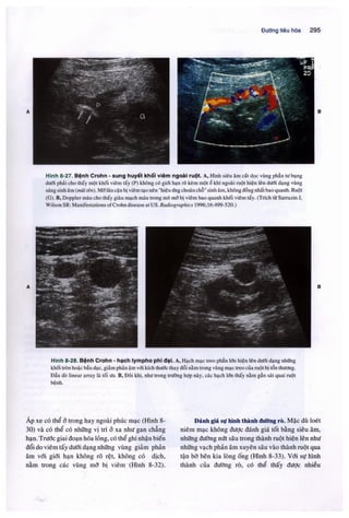 Siêu âm chẩn đoán