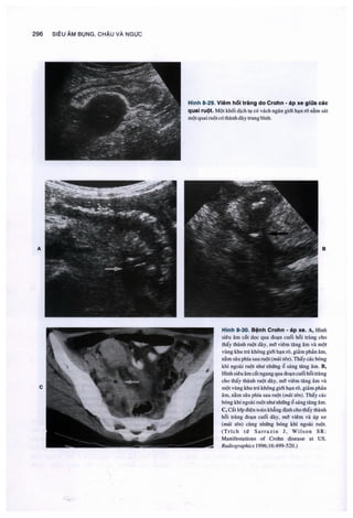 Siêu âm chẩn đoán