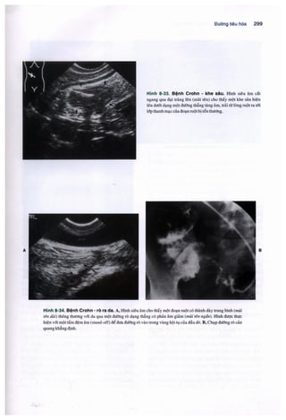 Siêu âm chẩn đoán