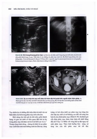 Siêu âm chẩn đoán