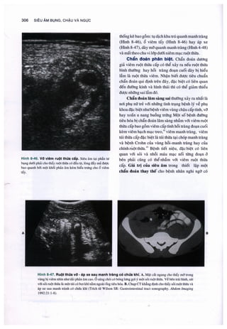 Siêu âm chẩn đoán