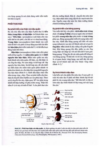 Siêu âm chẩn đoán