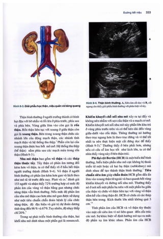 Siêu âm chẩn đoán