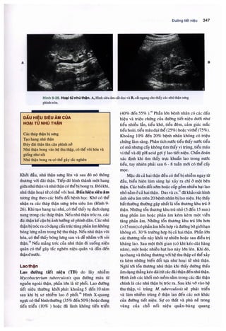 Siêu âm chẩn đoán