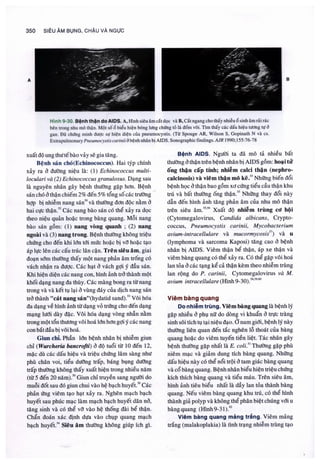 Siêu âm chẩn đoán