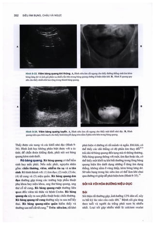 Siêu âm chẩn đoán