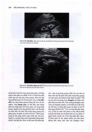 Siêu âm chẩn đoán